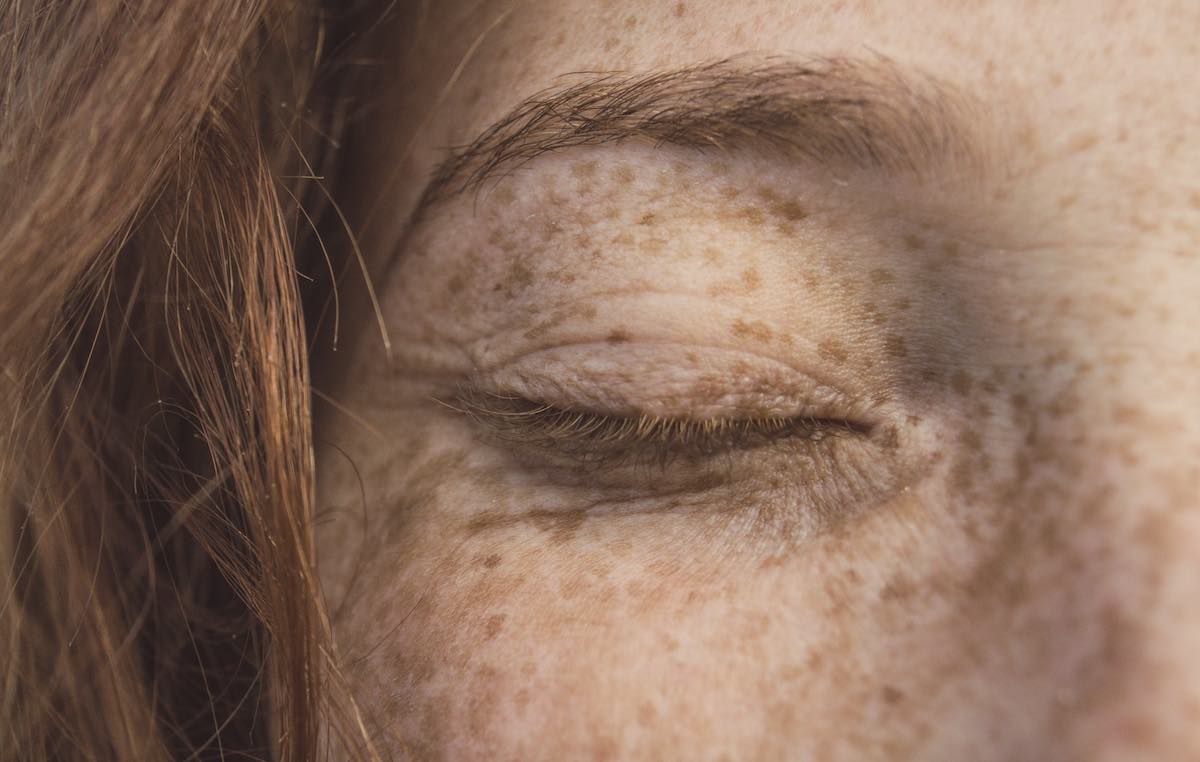 close-up of eye covered in freckles.